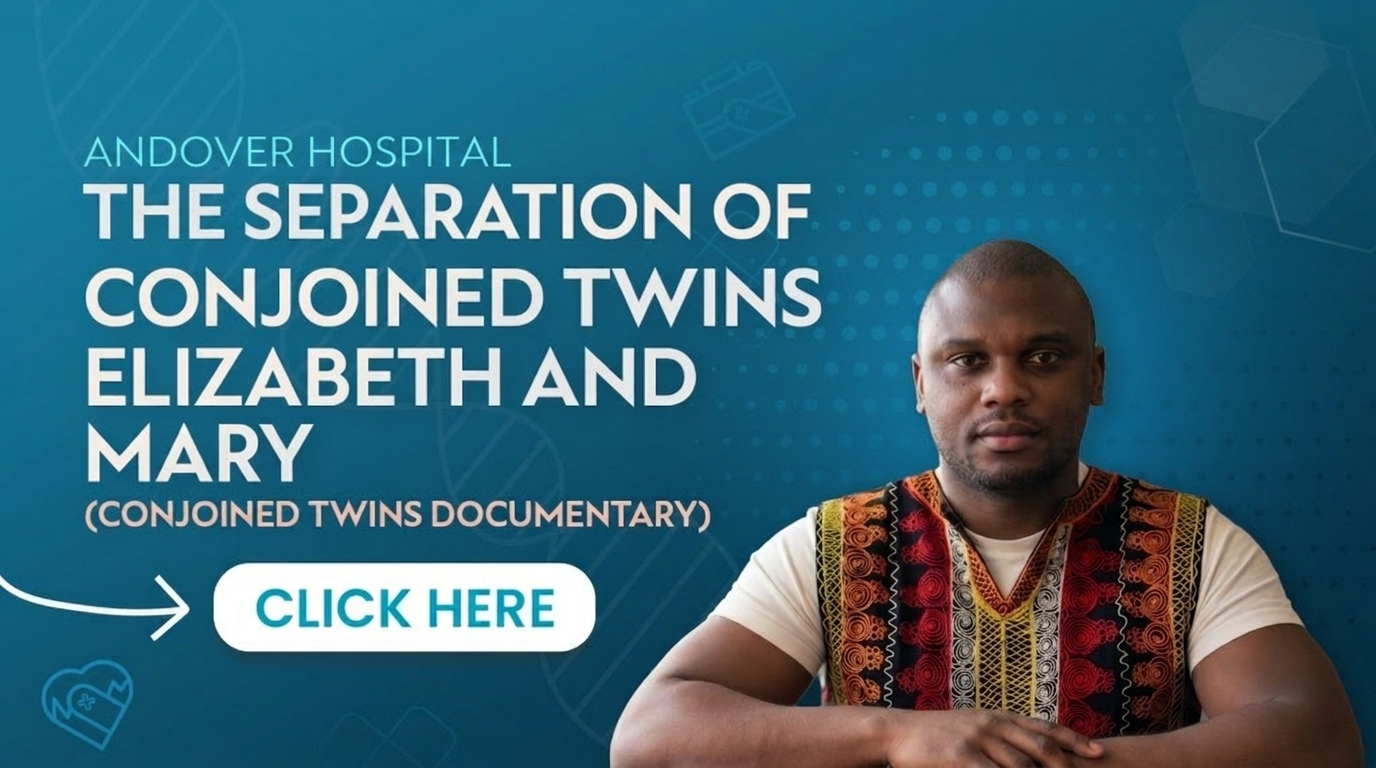 Conjoined Twins
